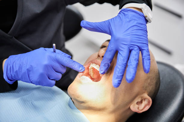 Best Broken or Chipped Tooth Repair in Tioga, ND